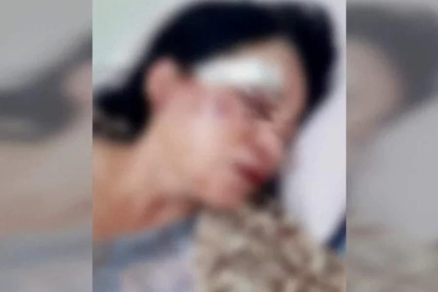 Mulher é espancada por vizinhos após festa ser denunciada por barulho