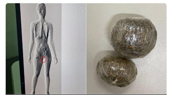 Mulher é presa tentando entrar em presídio de Itaitinga, no Ceará com droga nas partes íntimas