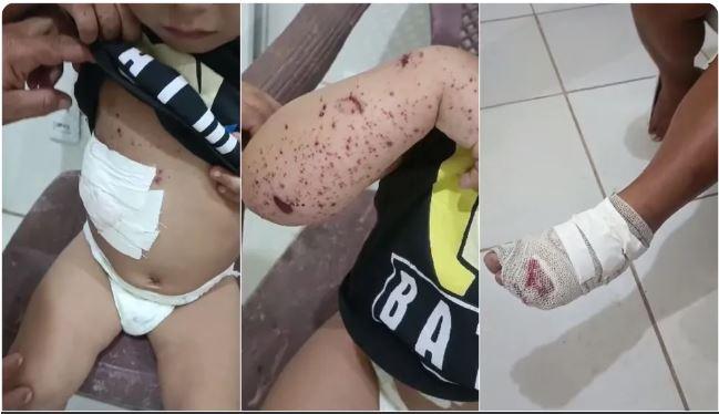 Raio atinge casa e deixa três feridos em Jijoca de Jericoacoara no Ceará