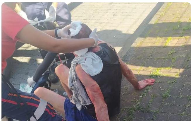 Homem tem olho perfurado por vizinho que invadiu apartamento pelado em SP