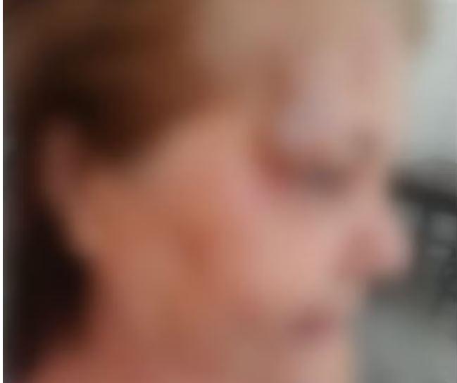 Idosa é agredida e estrangulada por vizinha dentro de elevador de prédio em Recife; 'Pensei que ia morrer', diz