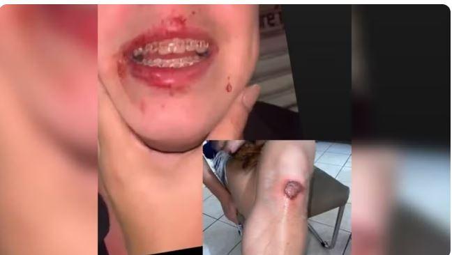 Policial é preso por agredir DJ que defendia amiga de assédio em festa de carnava em  São Benedito, no Ceará