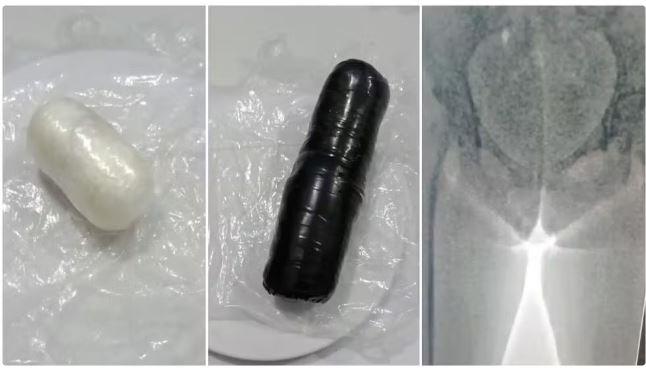 Mulheres são presas ao tentar entrar em presídio com drogas nas partes íntimas, na Grande Fortaleza