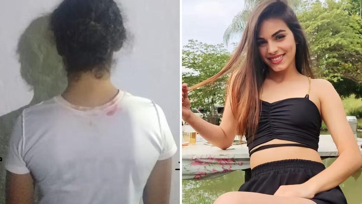Mulher suspeita de jogar ácido em jovem alega que vítima fazia críticas sobre sua aparência