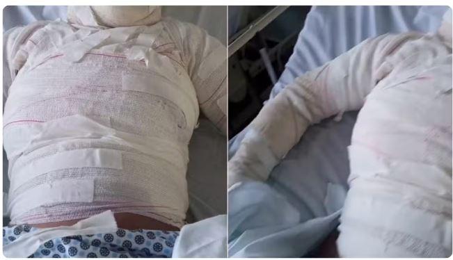 Homem ateia fogo e queima corpo de ex-mulher em Russas, no interior do Ceará; filha da vítima também sofreu queimaduras