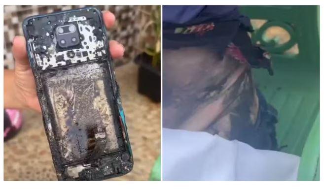 Celular pega fogo em cintura de técnica de enfermagem enquanto ela pilotava moto, no município do Crato, na região do Cariri cearense