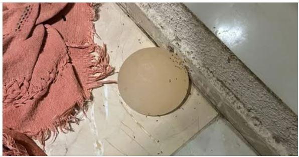 Mulher tem silicone arrancado com faca por marido no DF; homem foi preso em flagrante