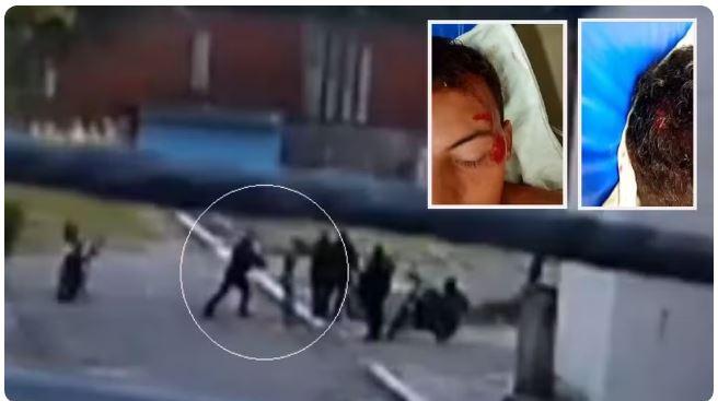 Policial arremessa bicicleta na cabeça de jovem com transtorno intelectual em  Aquiraz, na Região Metropolitana de Fortaleza