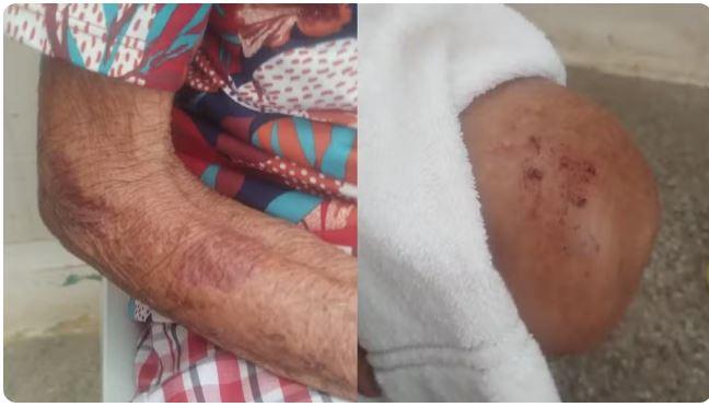 Idosa é hospitalizada após ser agredida pelo marido em Capistrano, no interior do Ceará