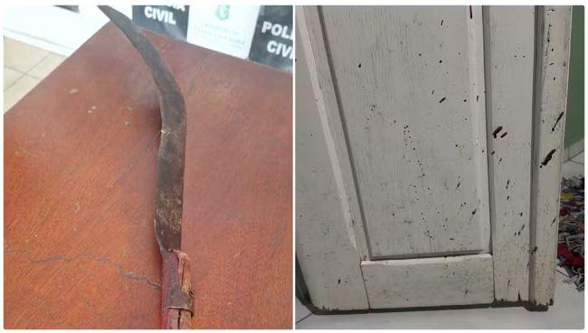 Vizinho decepa mão do outro com foice durante briga em Quixeramobim, no interior do Ceará, diz família